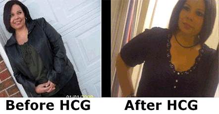 HCG Review 1
